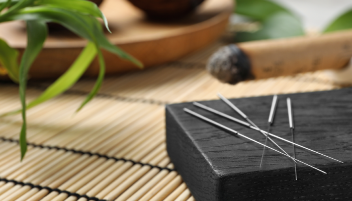 Acupuncture can help with many different types of chronic pain: Research