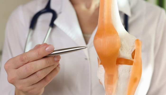 Study finds how stronger quadriceps can prevent knee replacement surgery